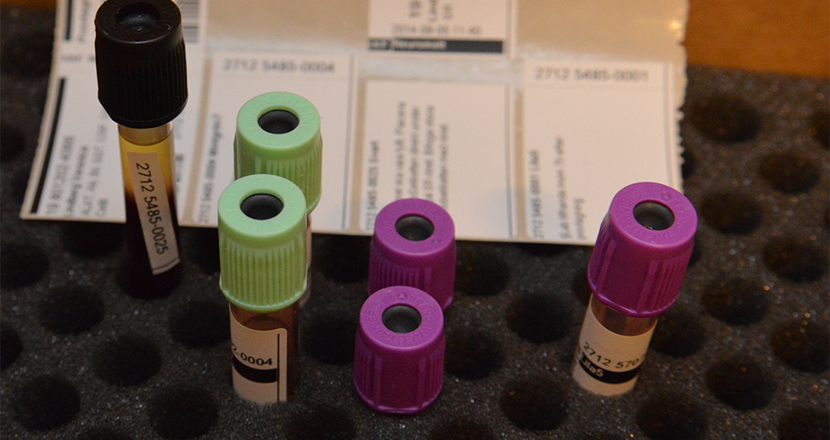 Blodprover på väg till laboratoriet. Foto.