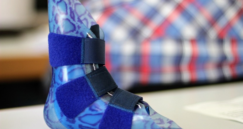 En blå forortos med leopardmönster. Foto.