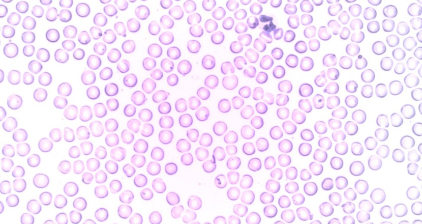 Mikroskopbild på blodceller. Foto.