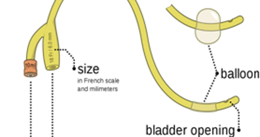 Tecknad korrigering av problem med blåsan. Illustration.