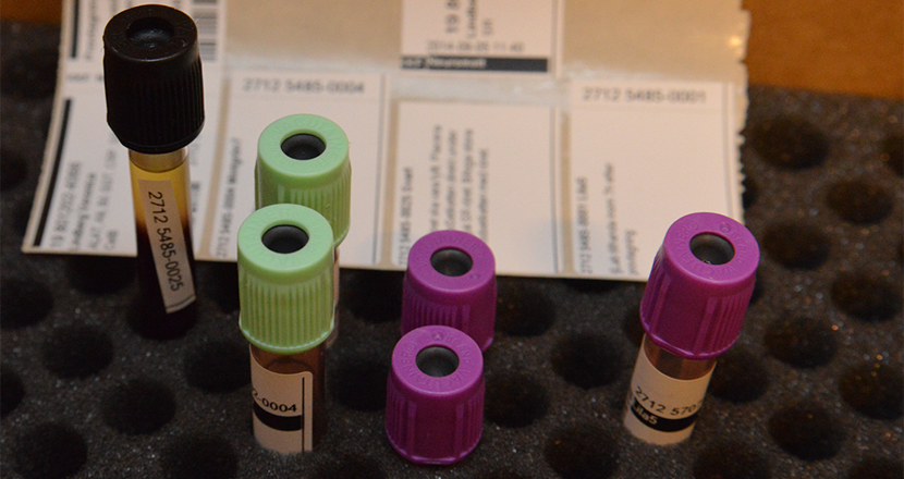 Foton på provrör med blod.