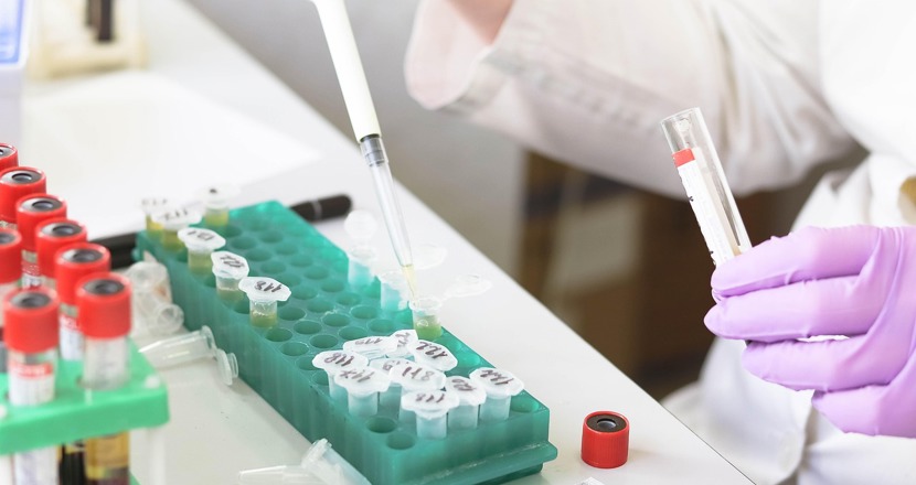 Generell bild på provtagning