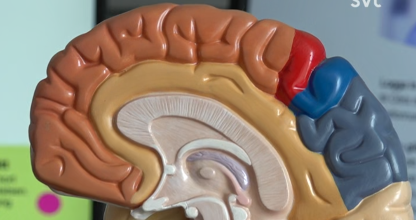 Färgglad modell av hjärnan som visar olika delar.