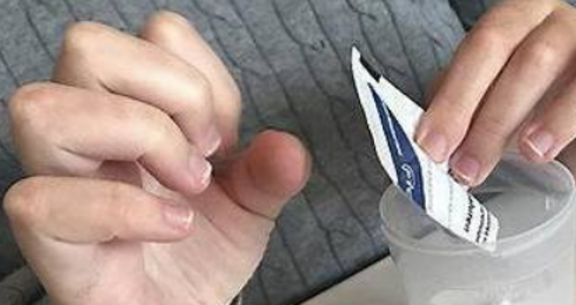 Bild på händer påverkade av muskler som förtvinat