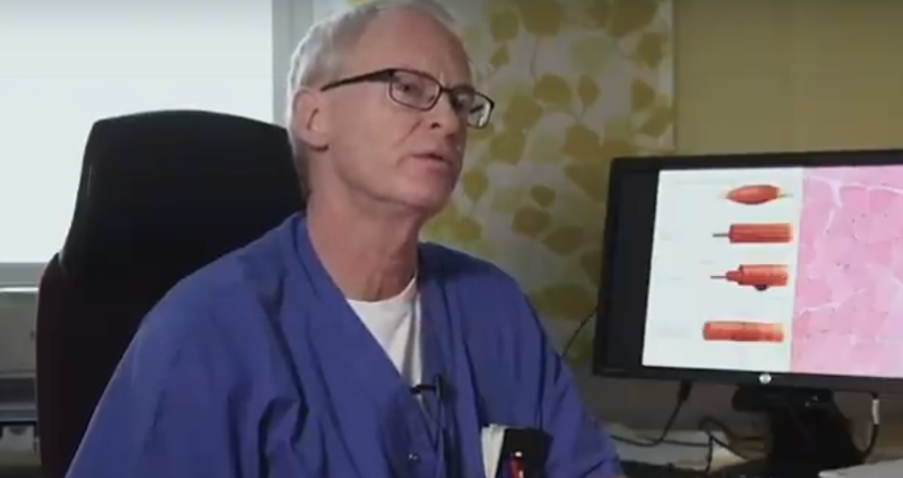 Foto på Cristopher Lindberg, neurolog på Sahlgrenska sjukhuset i Göteborg.