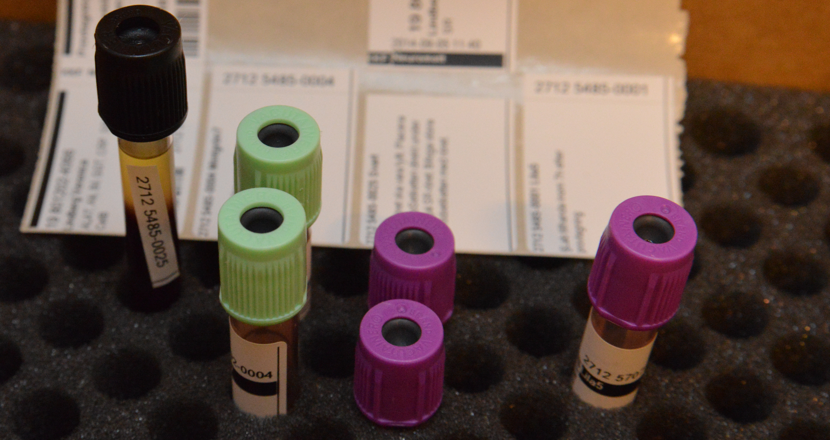 Provrör för blod i ett provrörsställ. Foto.